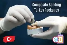 Composite Bonding Cost and Prices in Turkey