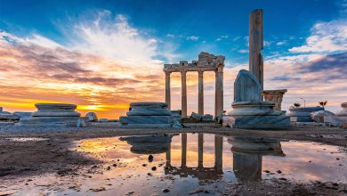 Composite Bonding in Antalya 114 Composite Bonding in Antalya