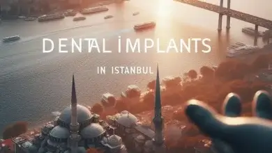 Dental Implants Cost & Prices in Turkey 116 Dental implants Cost and Prices in Turkey