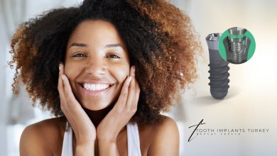 Antalya Dental Implants 117 Dental implants in Antalya