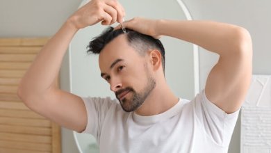 FUE Turkey Cost 1 FUE Hair Transplant Cost turkey
