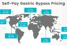 Gastric Bypass Cost and prices in Turkey