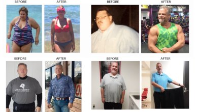 Gastric Sleeve Turkey Reviews 20 Gastric Sleeve in Turkey Reviews