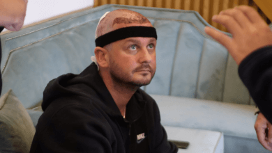 Hair Replacement Turkey 37 Hair Replacement in Turkey