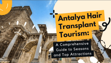 Hair Transplant in Antalya 87 Hair Transplant in Antalya