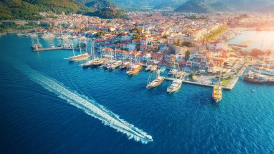 Hair Transplant in Marmaris 113 Hair Transplant in Marmaris