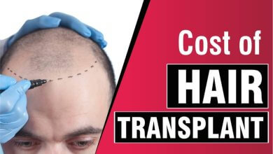 Hair Surgery Cost in Turkey 65 Prices and Cost of Hair Surgery in Turkey