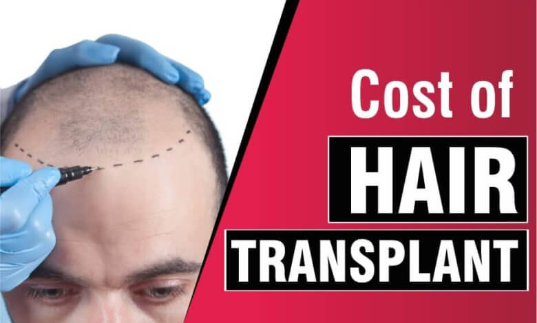 Hair Surgery Cost in Turkey 1 Prices and Cost of Hair Surgery in Turkey