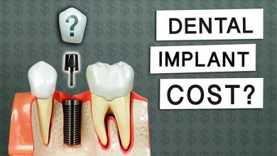 Tooth Implant Prices Turkey 114 Tooth implant Prices in Turkey
