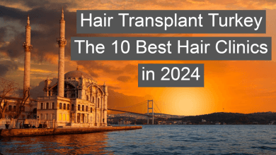 Top Hair Transplant Clinics in Turkey 1 Top Hair Transplant Clinics in Turkey