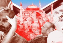 Top Hair Transplant in istanbul