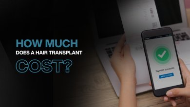 Turkey Hair Transplant Costs 76 Turkey Hair Transplant Costs and Prices