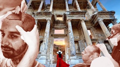 Hair Transplant in Izmir 102 hair transplant in izmir turkey