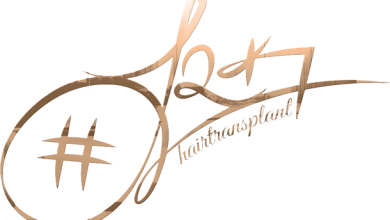 Serkan Aydin Hair Reviews 10 Serkan Aydin Hair 1