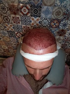 Hair Clinic in Istanbul 21 ChIJFy93LQ3HyhQRATWAUPO 1cQ