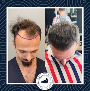 Prices and Cost of Beard Transplant in Turkey 25 ChIJZYs6o7LIyhQR