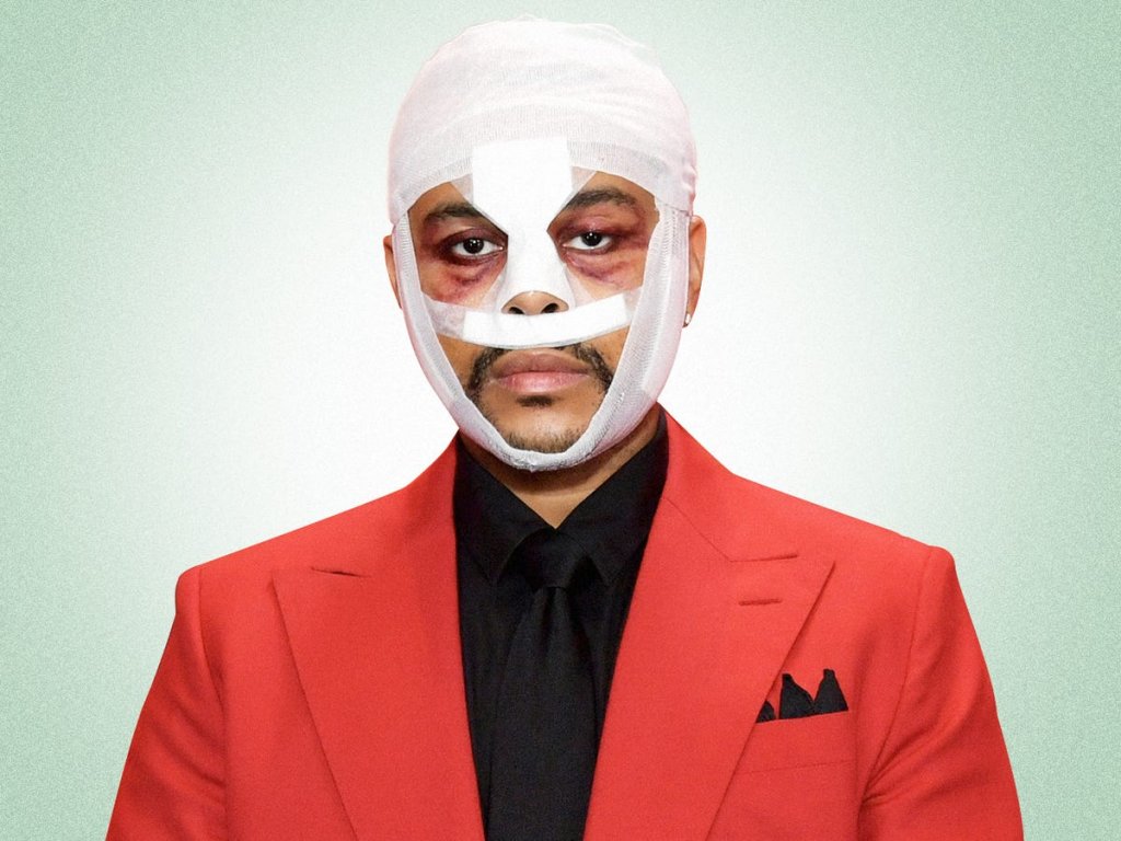 The Weeknd Plastic Surgery