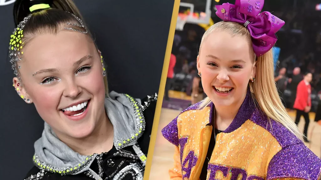 Jojo Siwa Veneers - Before & After 5 jojo siwa teeth veneers