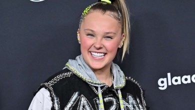 Jojo Siwa Veneers - Before & After 136 jojo siwa veneers dental