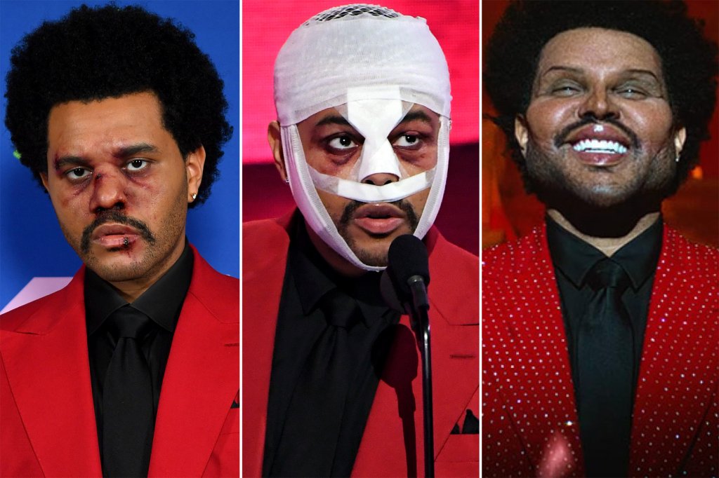 the weeknd plastic surgery operation