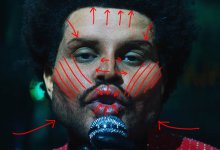 the weeknd surgery